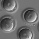 The first sign of successful in vitro fertilization, after co-injection of a gene-correcting enzyme and sperm from a donor with a genetic mutation known to cause hypertrophic cardiomyopathy.